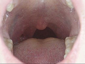 300人のおくち 第2集　サンプル画像07